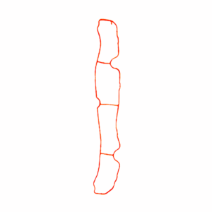 Empaque Junta De Múltiple De Admisión > 36-Ms4226-A Dc Gaskets